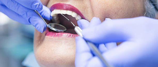 Best Dentist for Tooth Abscess  in Burns, TN